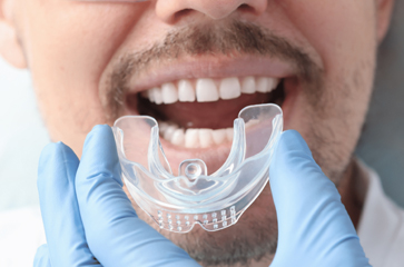 5 Good Reasons Why You Should Wear a Protective Mouthguard