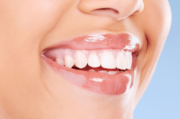 Understanding What is Cosmetic Dentistry: A Smile Revolution