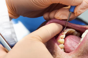 Healthy Gums: How Do They Look and How Can You Maintain Them?