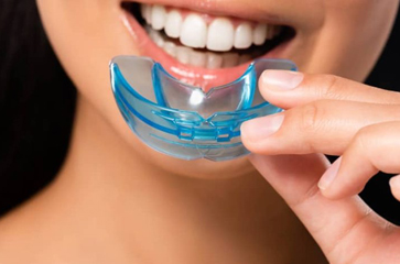 How Much Should You Expect to Pay for a Mouthguard?