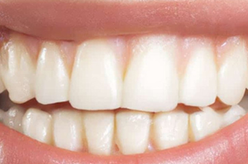 Gum Boil: Emergency or Not?