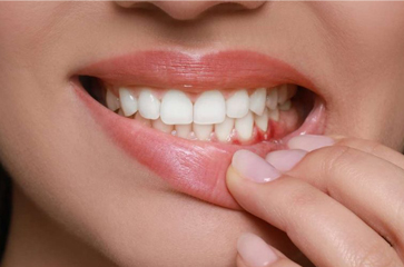 Healthy Gums Start with the Right Toothpaste: Our Top Picks