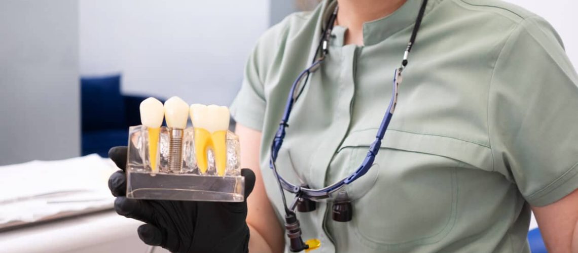 What Is the Process of Getting Dental Implants?